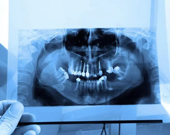 Emergency Dentist Modesto