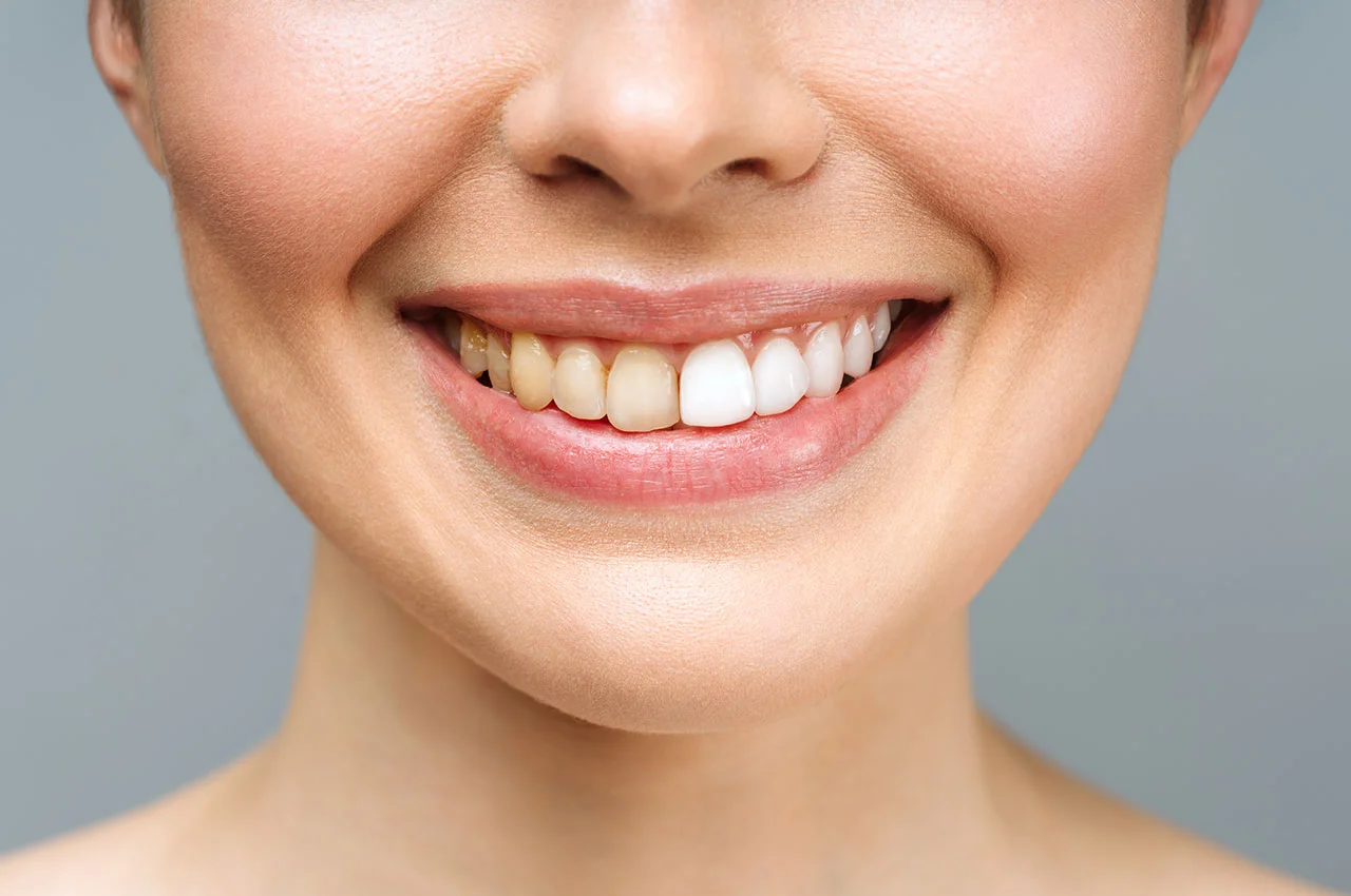 Wayne T. Yee, DDS Wayne T. Yee, DDS